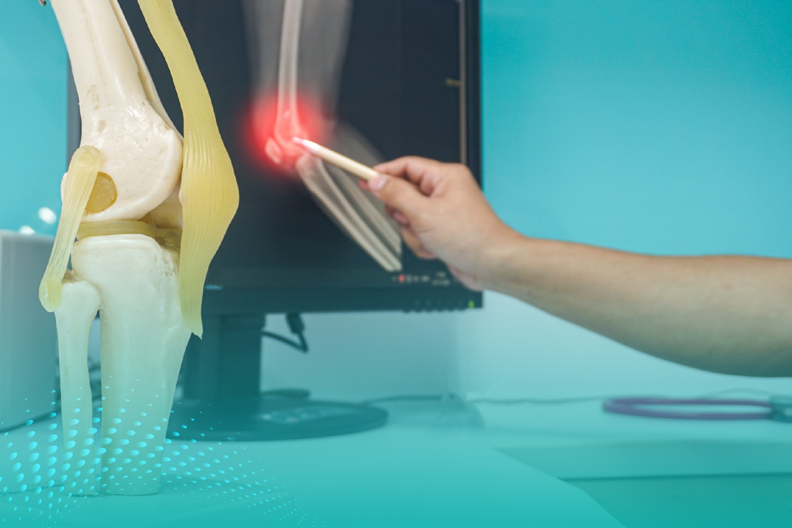 عيادة العظام في مجمع سرجكا الطبي